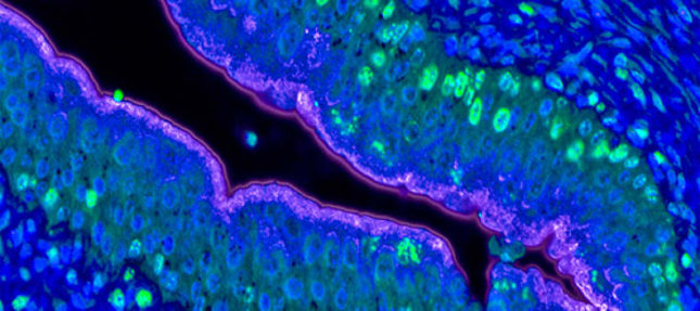 Urothelial stem cell